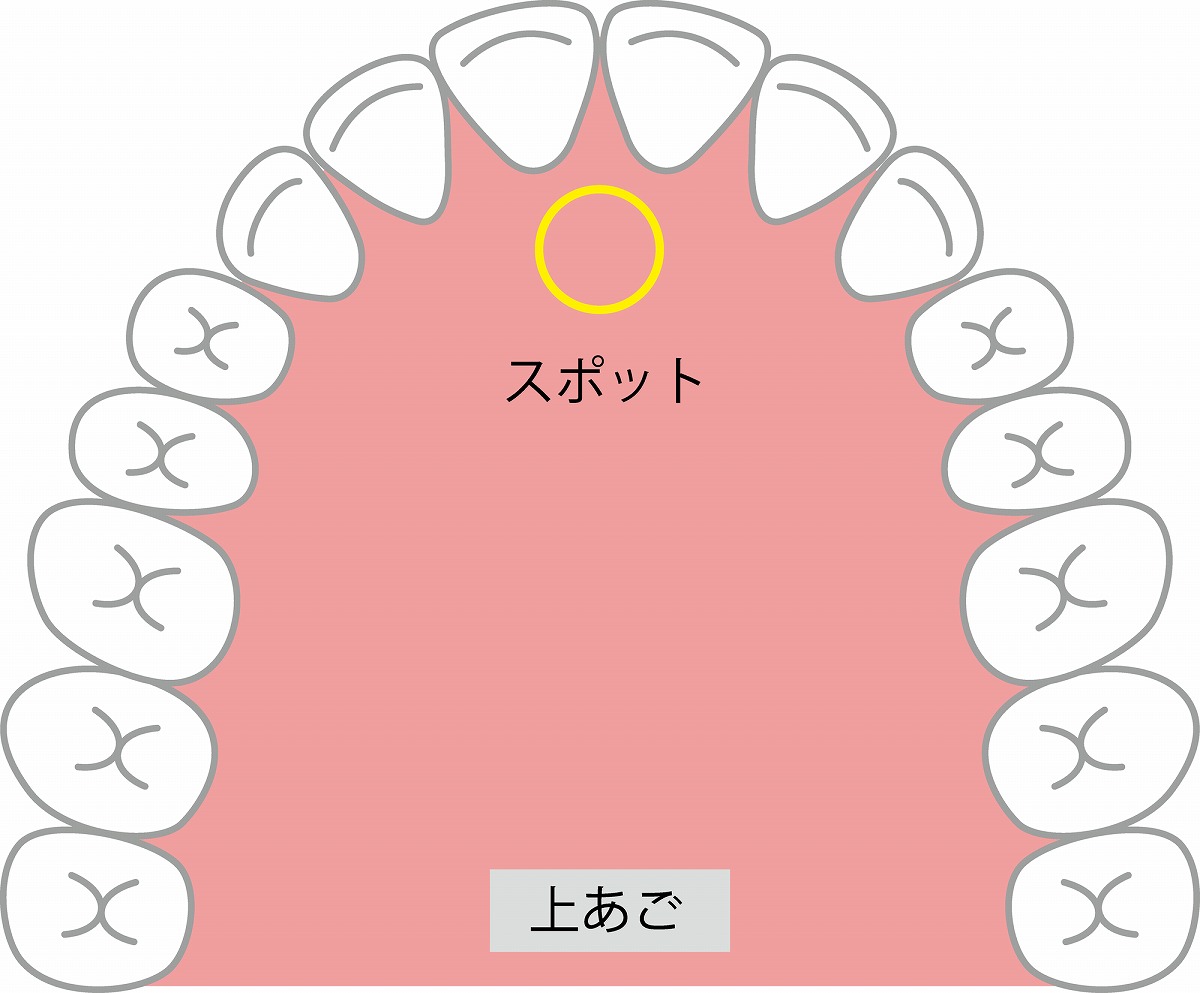 口腔機能発達不全症を予防するための歯並び予防